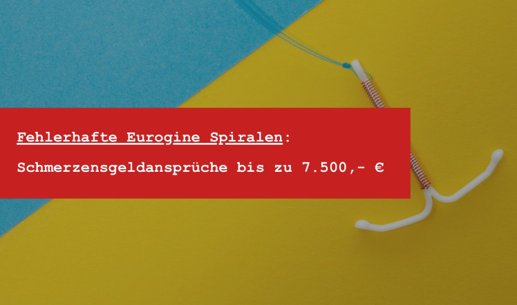 Eurogine Spirale: Produktfehler und die rechtlichen Konsequenzen